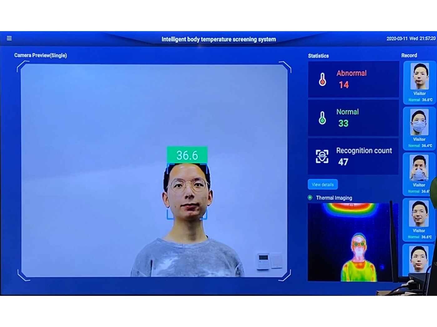Remote AI Temperature Screening System - Image 5